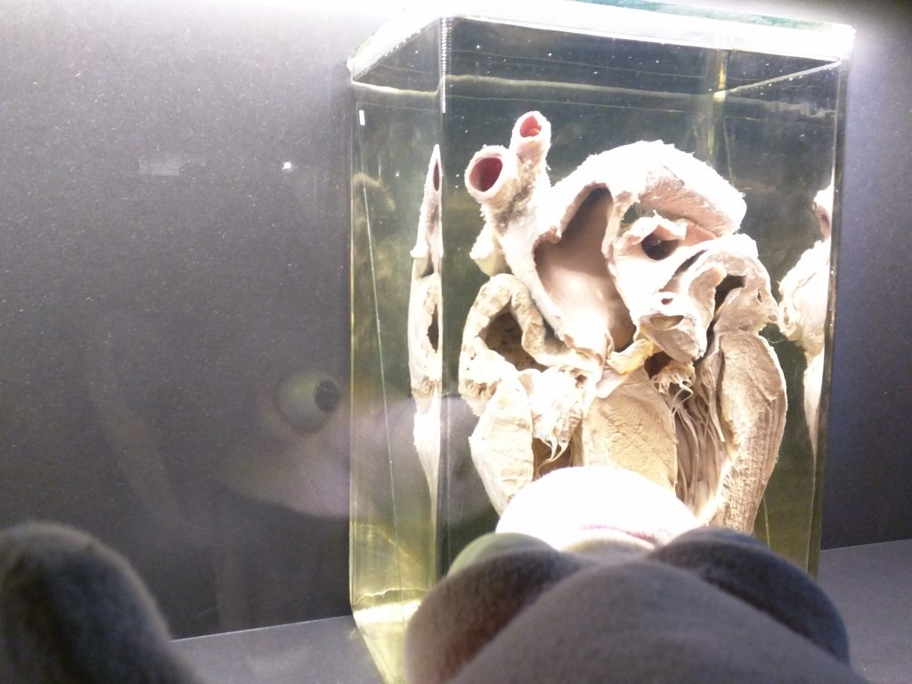 begehbare Herzensangelegenheiten Kinderakademie Fulda Noppes